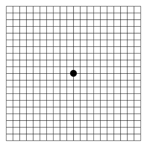 image depicting an amsler grid pattern test